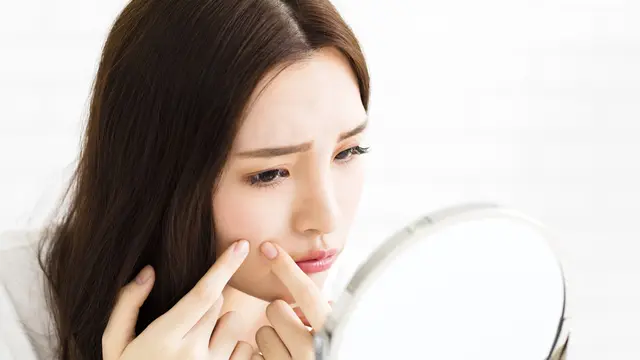 Cegah Jerawat Pecah Berbekas, Yuk Lakukan Rutinitas Perawatan yang Tepat!