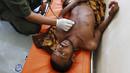 Petugas memeriksa kondisi kesehatan pengungsi etnis Rohingya di Lhoksukon, Aceh, Senin (11/5/2015). Sekitar 500 migran terdampar di pantai Aceh setelah terapung-apung di laut selama sebulan karena kehabisan bahan bakar. (REUTERS/Roni Bintang)
