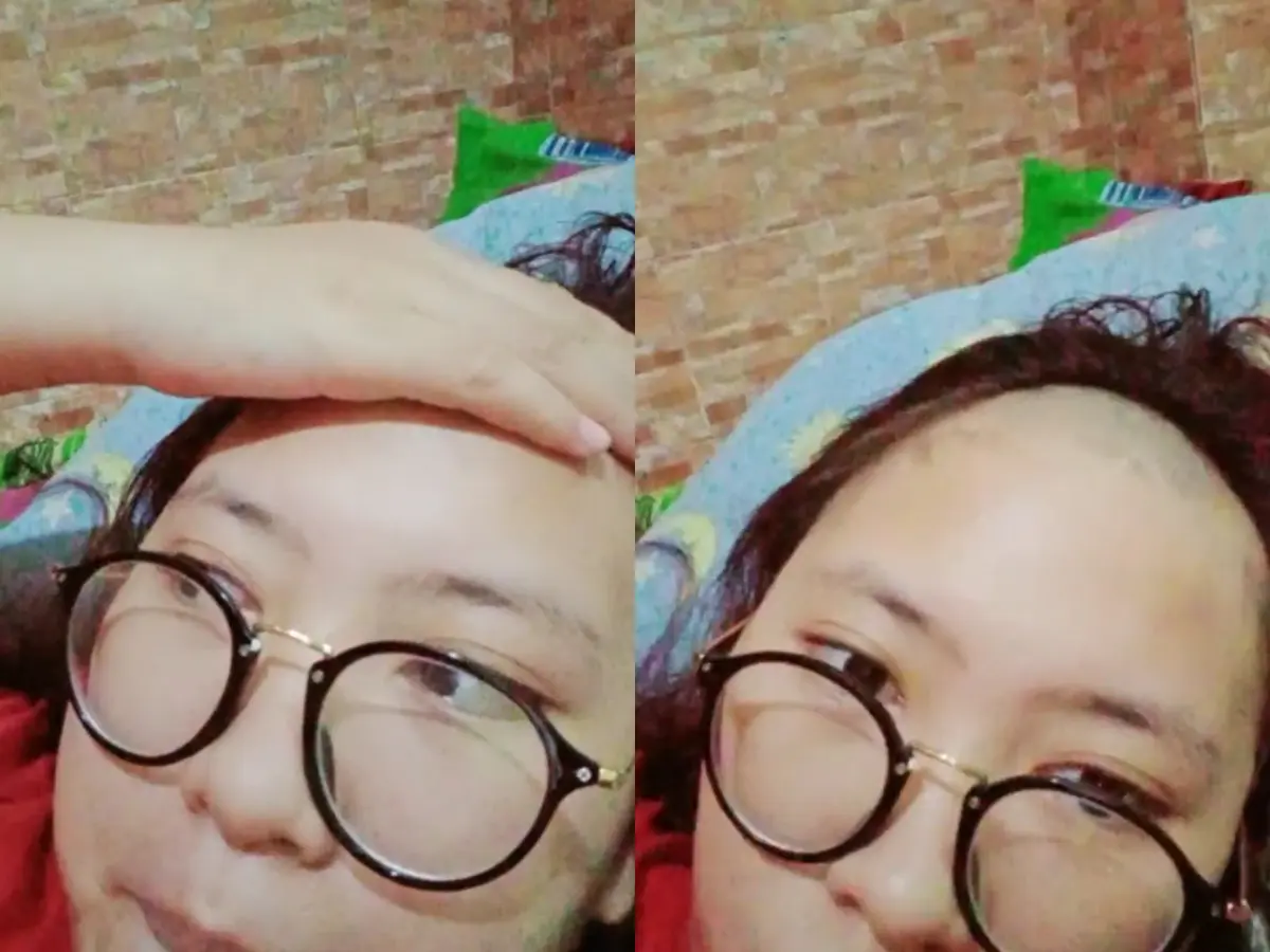 Viral Video Remaja Potong Poni Sendiri, Hasilnya Bikin Warganet Tertawa -  Citizen6 Liputan6.com