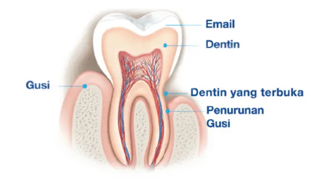 Ilustrasi penyebab gigi sensitif.