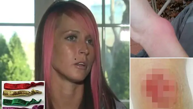 Karena Ikat Rambut di Pergelangan, Nyawa Perempuan Ini Terancam