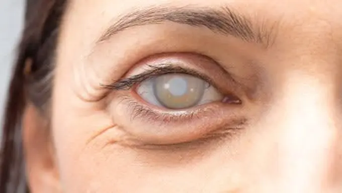 Ilustrasi. (foto: Pinterest/All About Vision).