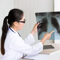 Kenali ciri-ciri awal kanker paru agar bisa ditangani lebih cepat dan tepat. (foto/dok: freepik)