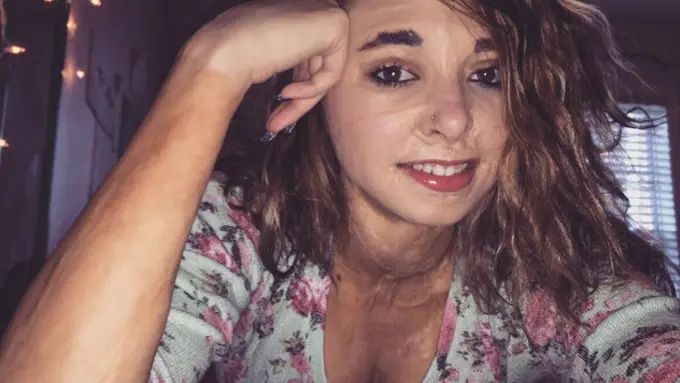 Ketika Sebuah Tato Mengubah Pilu Jadi Rasa Syukur