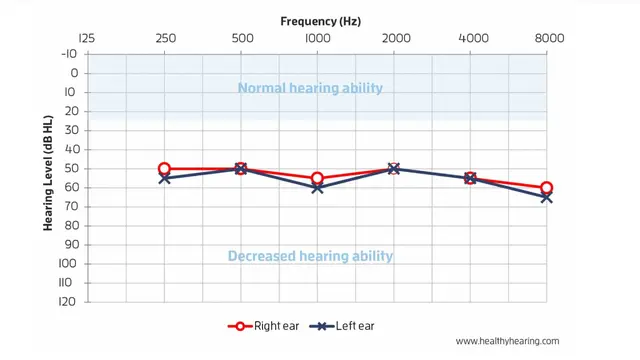 Hearing Level. Foto: healthyhearing.com