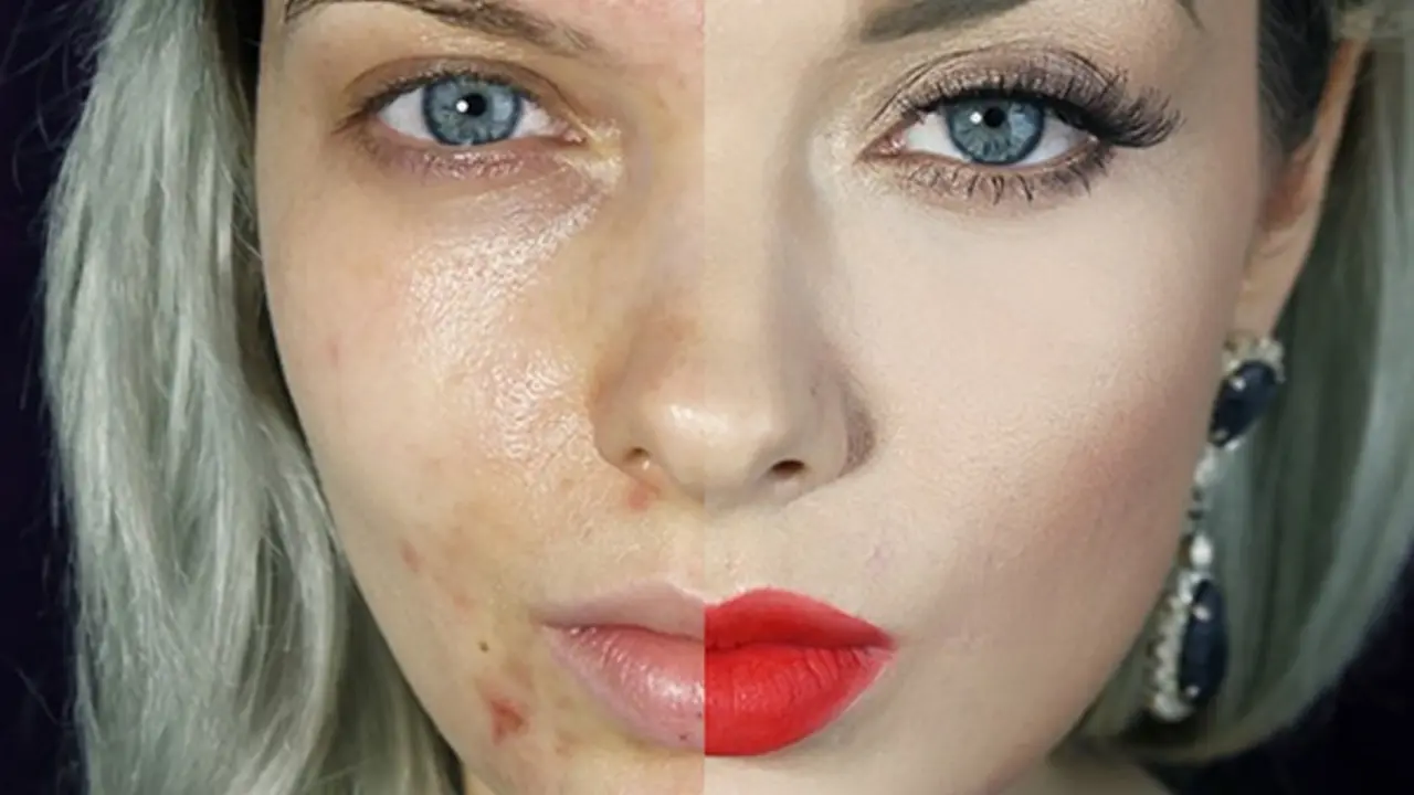 10 'Beauty Vloggers' Ini Ternyata Punya Wajah Penuh Jerawat