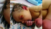 Bayi 'Berselimut' Semut Ditemukan di Hutan Rusia