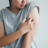 ilustrasi eksim/nednapa/shutterstock