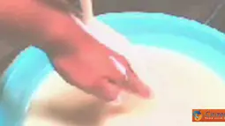 Obat Luka Bakar 