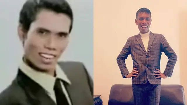 Beda Penampilan 5 Seleb Dadakan yang Kini Meredup, Dulu Vs Sekarang