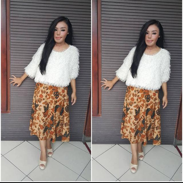 6 Potret Terbaru Lisa, Korban Penyiraman Air Keras Kini Jadi Pengusaha Perhiasan