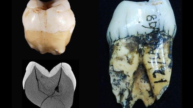 (kiri atas) Fosil gigi Homo sapiens temuan terbaru di Gua Lida Ajer, Sumatera Barat (Chris Clarkson, Kira Westaway, dkk)