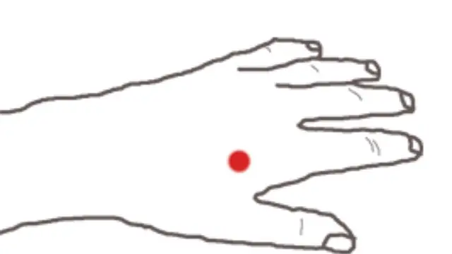 [Bintang] Akupunktur