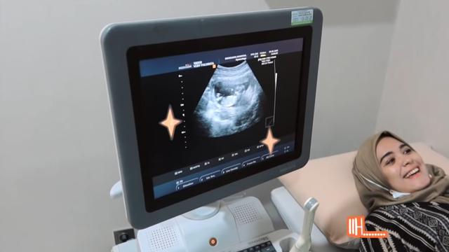 Hamil Anak Pertama, Ini 6 Momen Vebby Palwinta dan Razi Bagikan Kabar Bahagia