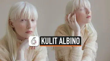 THUMBNAIL KULIT ALBINO