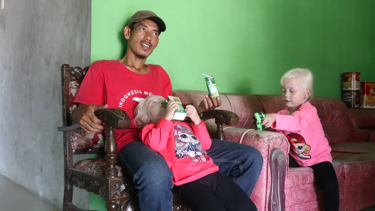 Kembar Albino Wonogiri