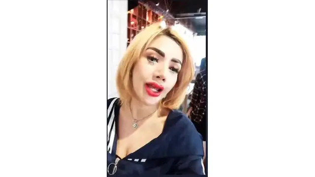 Penampilan baru Barbie Kumalasari tengah menjadi sorotan, bibirnya terlihat tebal dan merah.