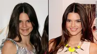 Berikut metamorfosa Kendall Jenner dari waktu ke waktu.