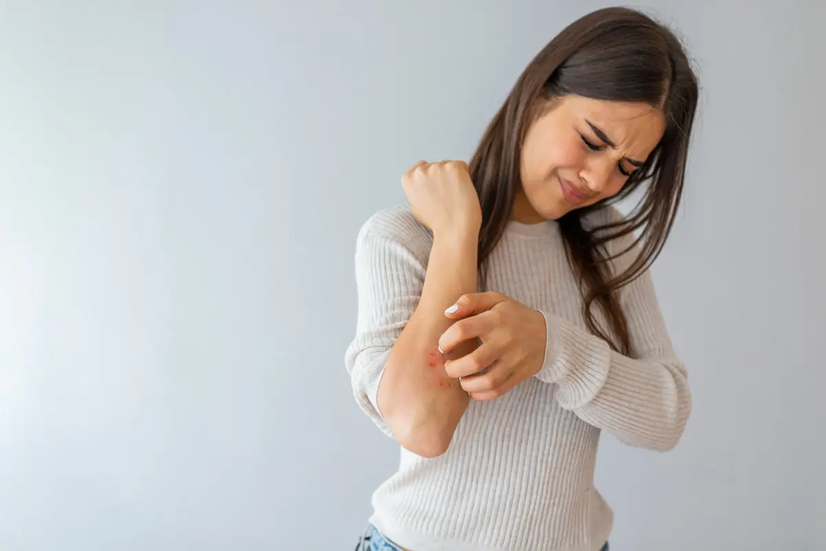 Ilustrasi psoriasis