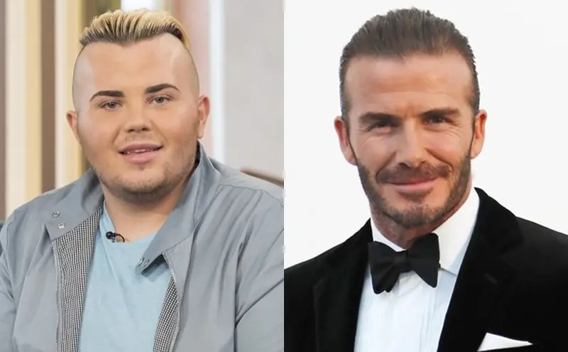 Seorang penggemar David Beckham telah menghabiskan uang hingga 360 juta rupiah lebih untuk operasi agar terlihat seperti idolanya. (Doc: ITV/REX/Shutterstock)