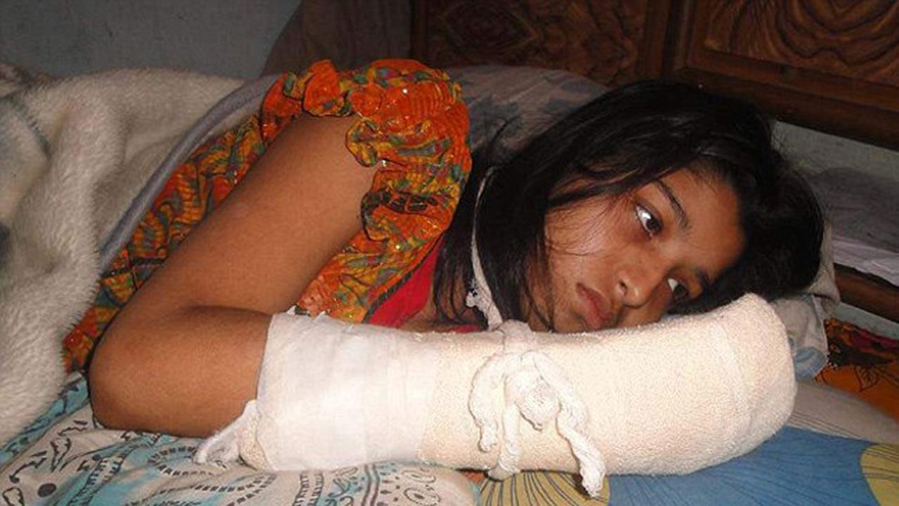 Tragis, Suami Tega Potong Jari Tangan Istri Agar Tak Jadi Sarjana