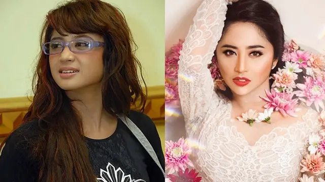 Potret Penyanyi Cantik Sebelum dan Sesudah Tanam Benang