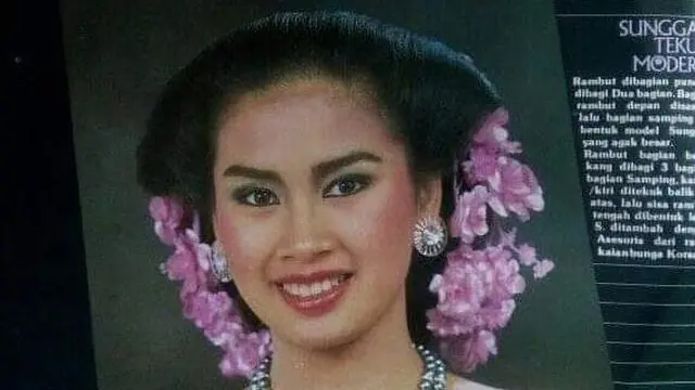 Titi DJ Sebelum Kenal Operasi Plastik