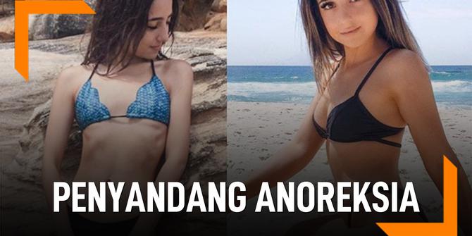 VIDEO: Transformasi Mantan Penyandang Anoreksia, Dulu Beratnya 29 Kg