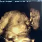 terkejut ketika melihat hasil scan USG 4D, wanita ini tak hanya melihat sosok bayi, melainkan melihat pria mencium bayinya.