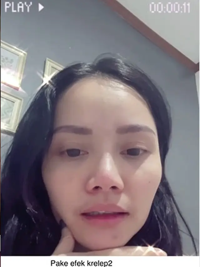 Mawar AFI 1 Terpapar Covid-19, Alami Gejala Batuk Kering dan Sesak
