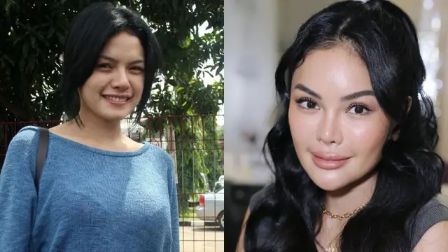 Filler Rahang 350 Juta