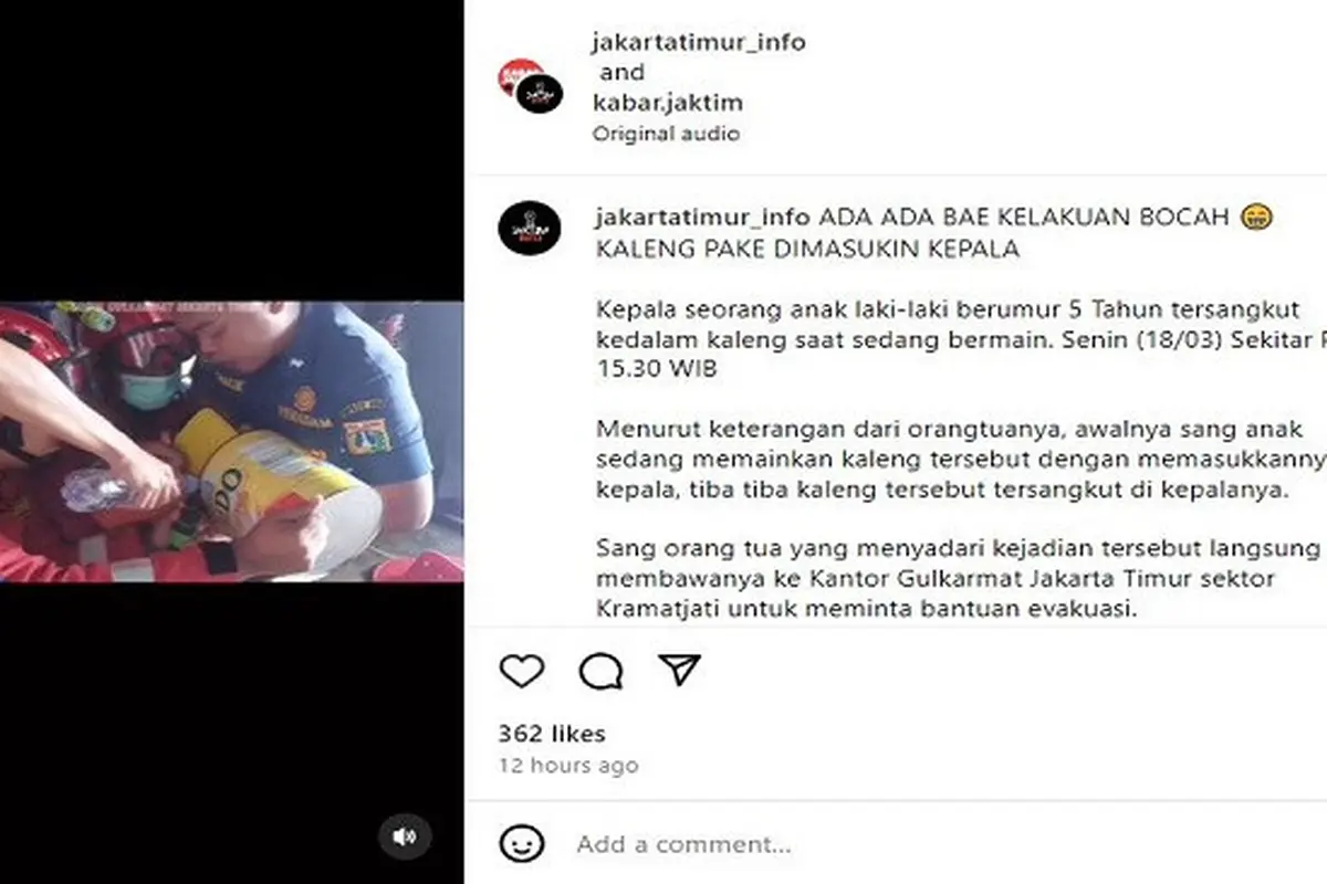 Kepala seorang bocah laki-laki di Jakarta Timur tersangkut kaleng susu. Peristiwa yang menimpa bocah bernama Ahmad (5) ini terjadi pada Senin 18 Maret 2024.