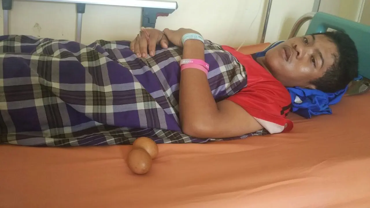 Temuan Penting Dokter Soal Fenomena Remaja Bertelur Ayam
