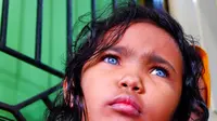 Anak bermata biru di Pekanbaru, Dzakira Azizy Naqiya. (Liputan6.com/M Syukur)