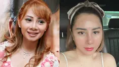 Baru-baru ini seleb Femmy Permatasari sedang ramai diperbincangkan. Ia unggah foto beda penampilannya saat dulu vs kini yang sukses bikin pangling. Meski kini sudah berusia 48 tahun, Femmy tetap terlihat awet muda berkat perawatan dan operasi plastik. (Liputan6.com/IG/femmypermatasari)