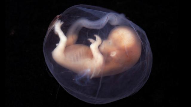 Janin dalam kandungan