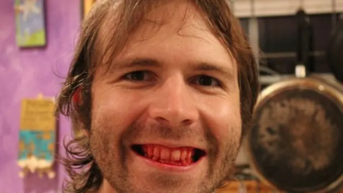 Kecuali Daging Mentah, Pria Ini Tak Makan Apapun Selama 7 Tahun