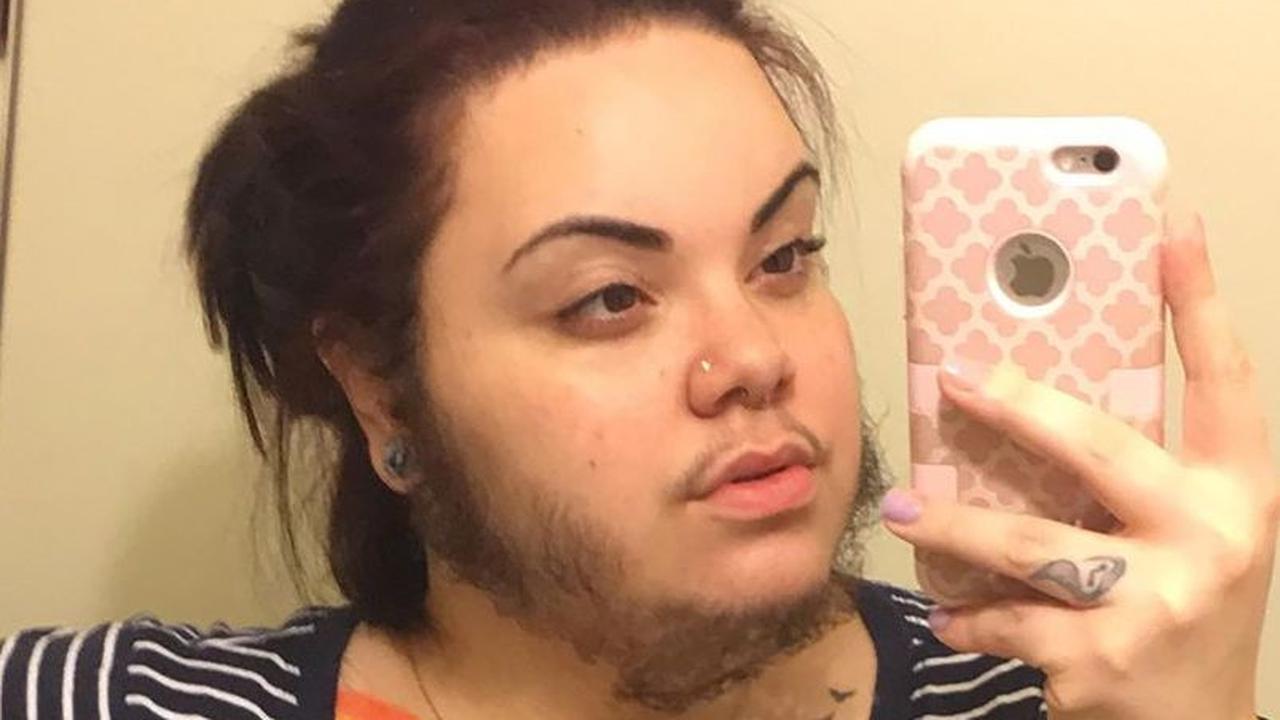 Di-Bully Berjanggut, Wanita Ini Tetap PD dan Disayang Pacarnya