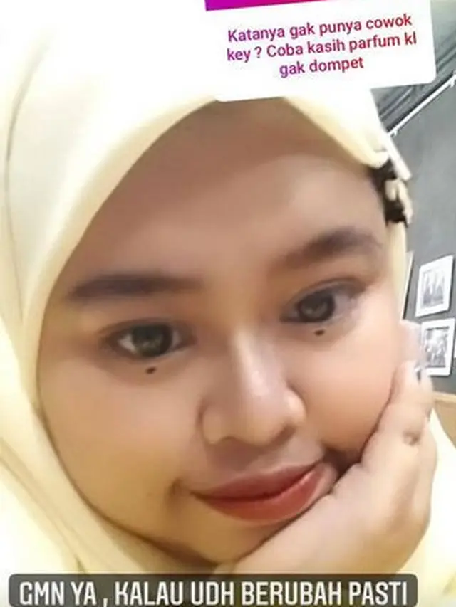 6 Potret Terbaru Kekeyi Setelah Filler Hidung, Tampil Beda