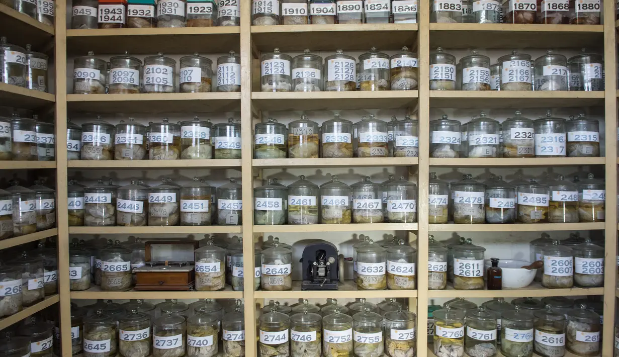 Koleksi otak manusia yang diawetkan di Museum Neuropatologi, di Rumah Sakit Santo Toribio de Mogrovejo, Lima, Peru (16/11). RS ini menyimpan sekitar 290 otak manusia yang dapat dilihat langsung sebagai bahan pembelajaran. (AFP Photo/Ernesto Benavides)