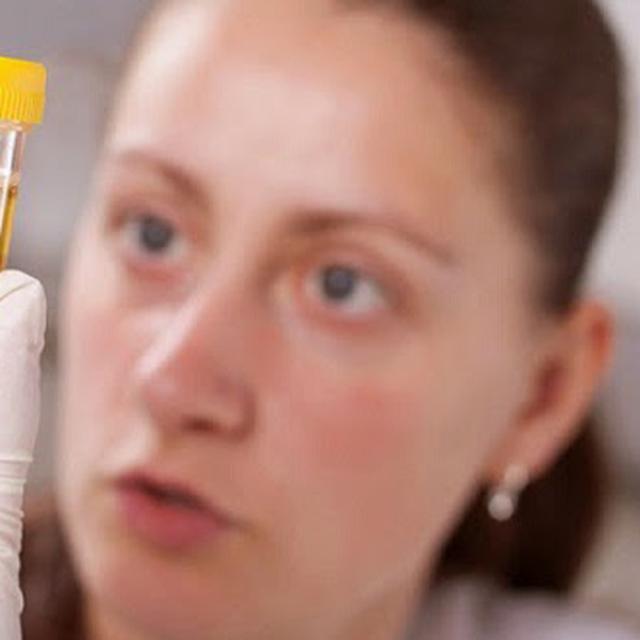 Urine Sembuhkan Banyak Penyakit Health Liputan6 Com