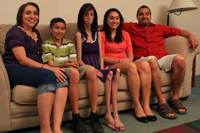 Lizzie Velasquez (tengah) bersama keluarga