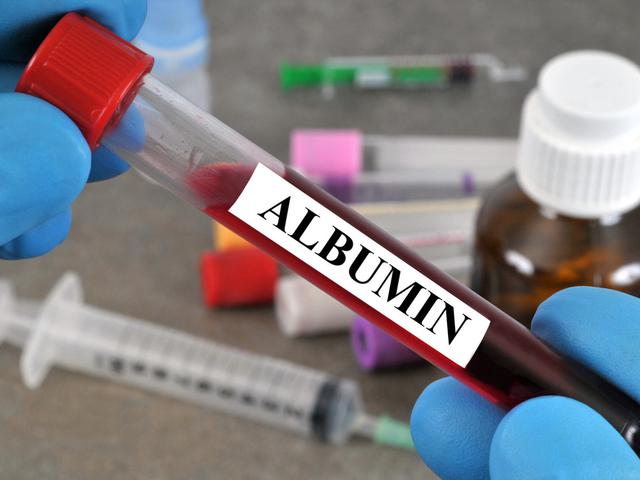 Fungsi Albumin Dalam Tubuh Dan Bahayanya Apabila Kekurangan Hot Liputan6 Com