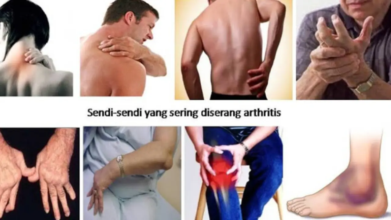 6 Mitos Mengenai Radang Sendi
