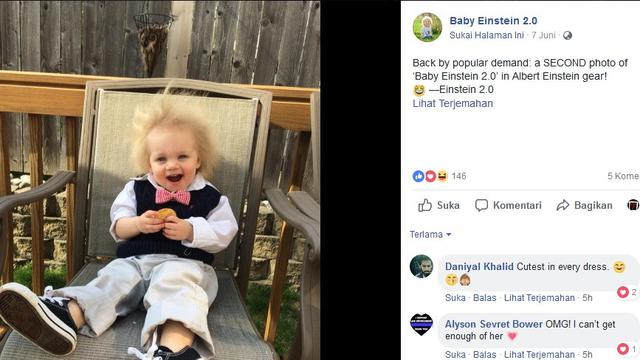 Bayi Lucu Ini Punya Rambut Jabrik Mirip Albert Einstein Health Liputan6 Com