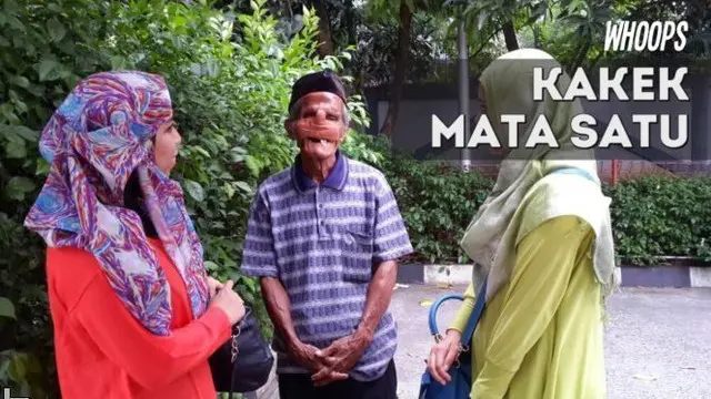 Walaupun wajah penuh balutan, Abdul tak menyerah dan memilih bertahan hidup tanpa meminta belas kasihan.