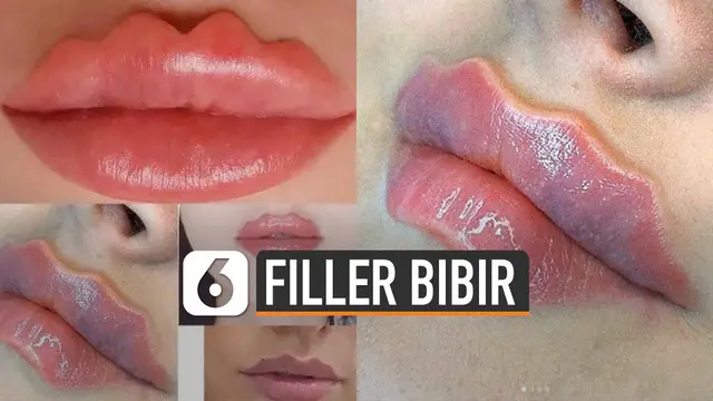 VIDEO: Ikut Tren Filler Bibir Keriting Bisa Diakali Dengan Cara ini