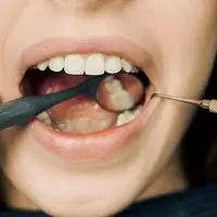 Benarkah Sering Minum Teh Membuat Gigi Menjadi Kuning?