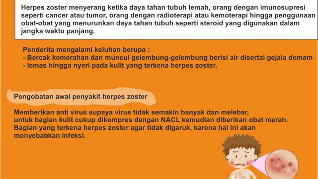 Infografis Herpes Zooster