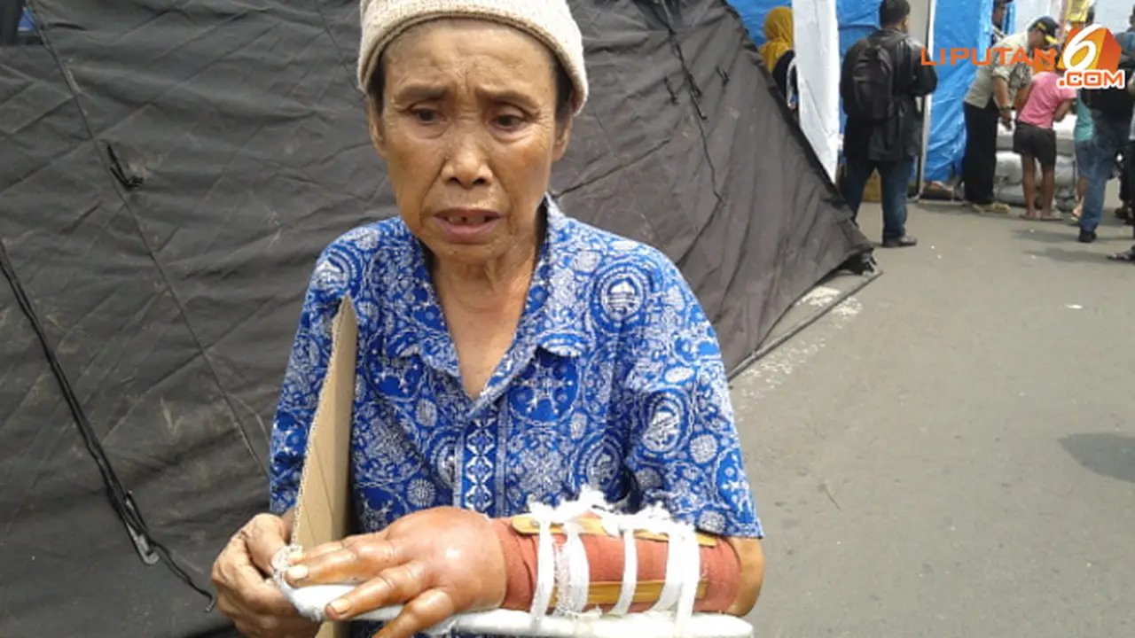 nenek-patah-tangan-131001b.jpg